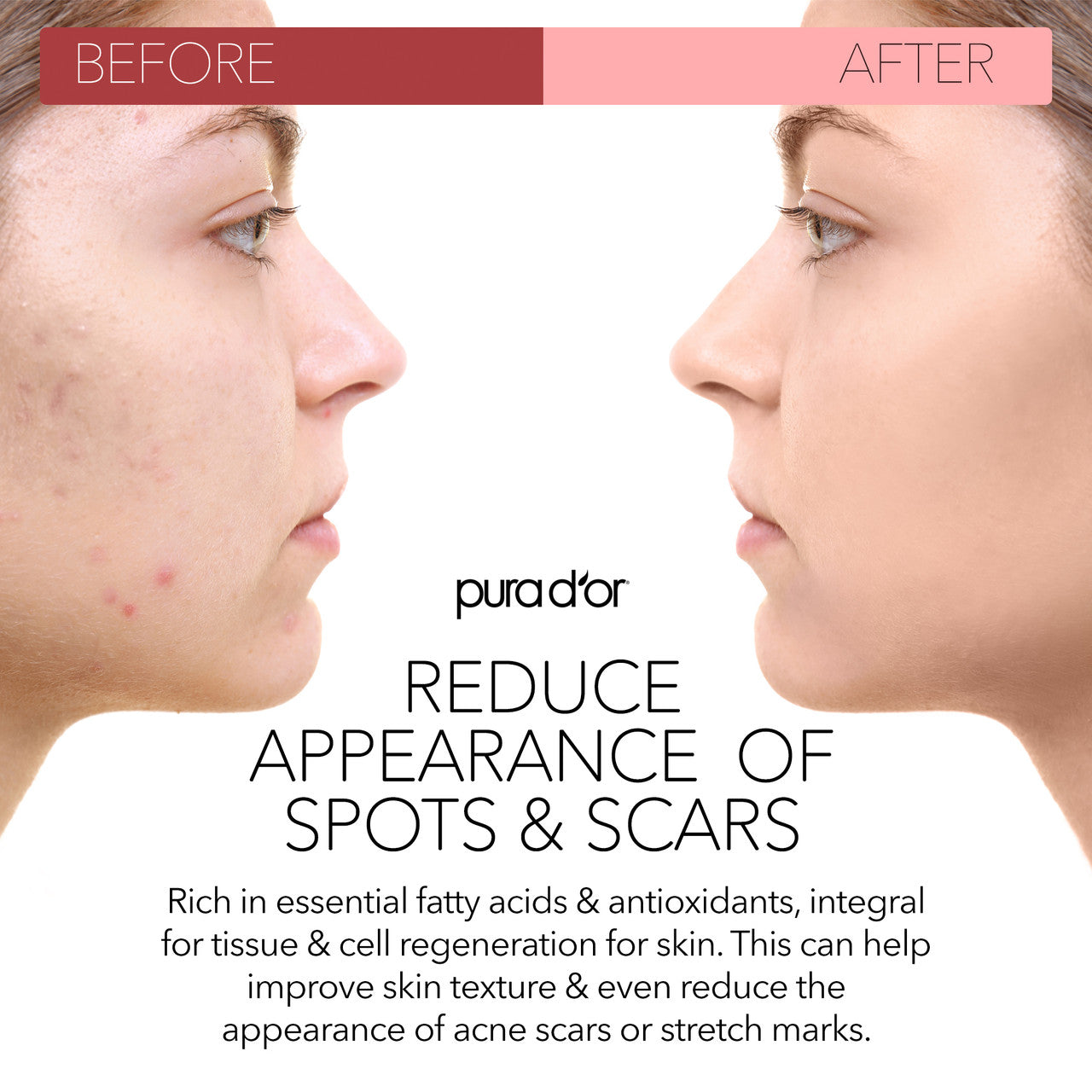 OG1 PURDR SD OIL ROSEHIP ( 1 X 4 OZ   )-2