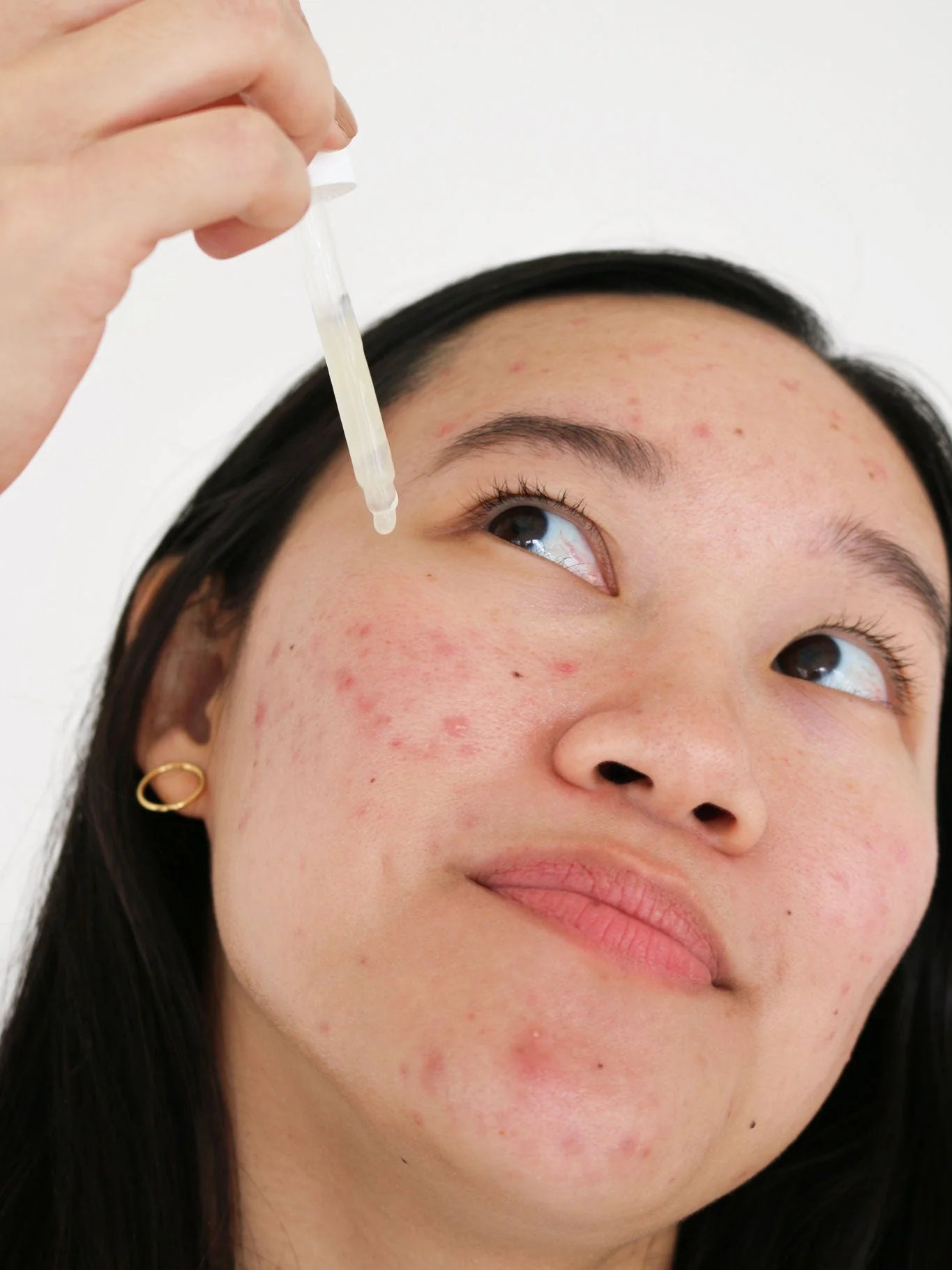 COCOKIND Postbiotic Acne Serum